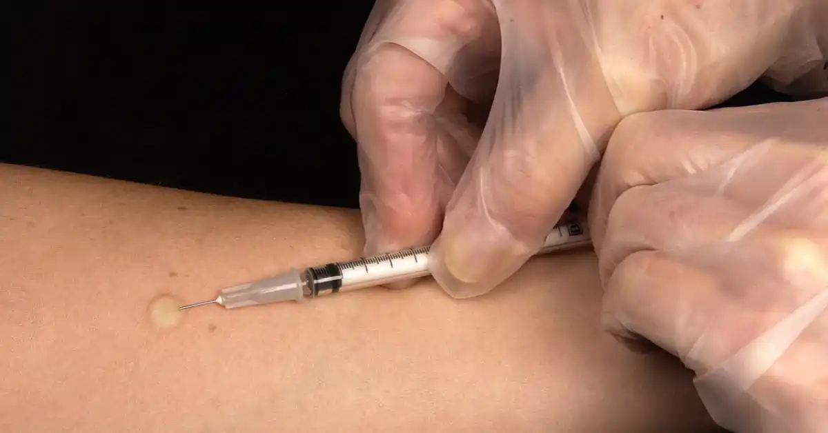 Patanjali Medicine for Tuberculosis