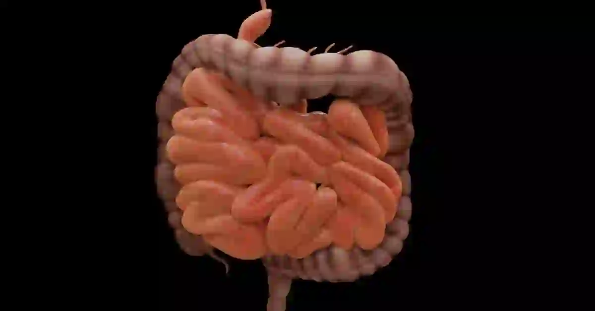 Patanjali Medicine for Intestinal Tuberculosis