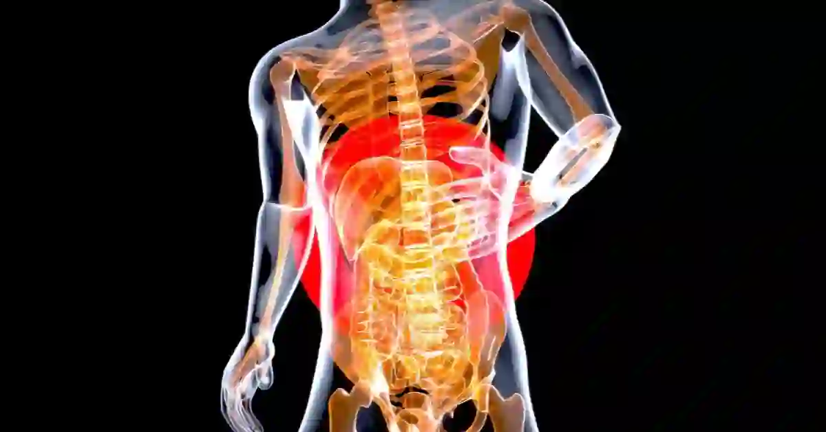 Patanjali Medicine for Intestinal Tuberculosis..